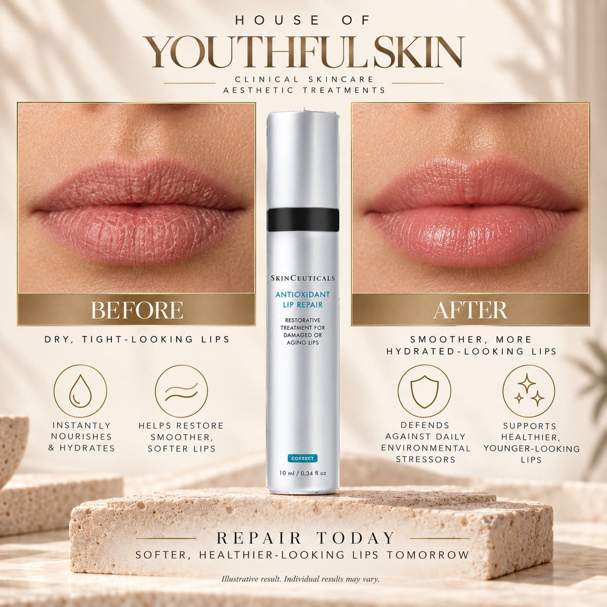 AOX LIP REPAIR 10ML