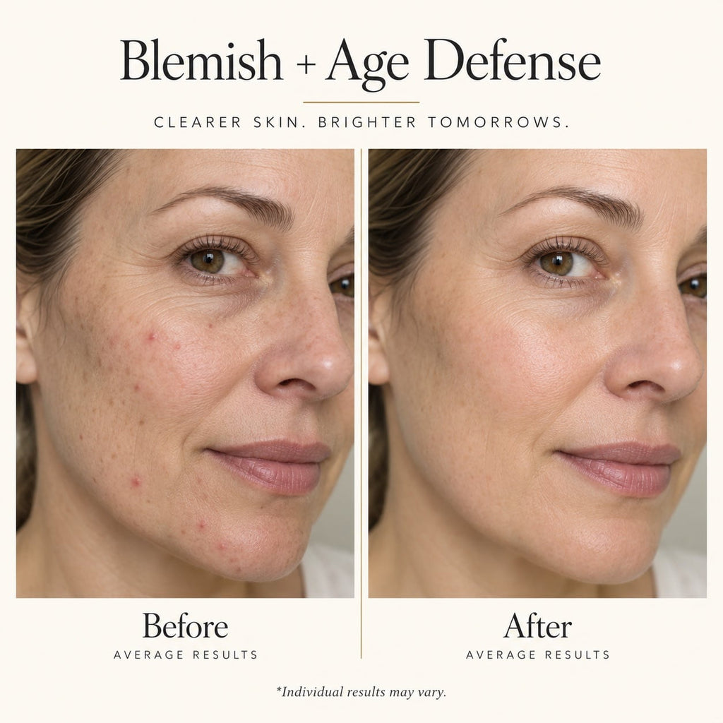 BLEMISH + AGE DEFENSE 30ML