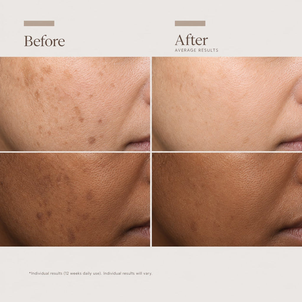 DISCOLORATION DEFENSE SERUM 30ML