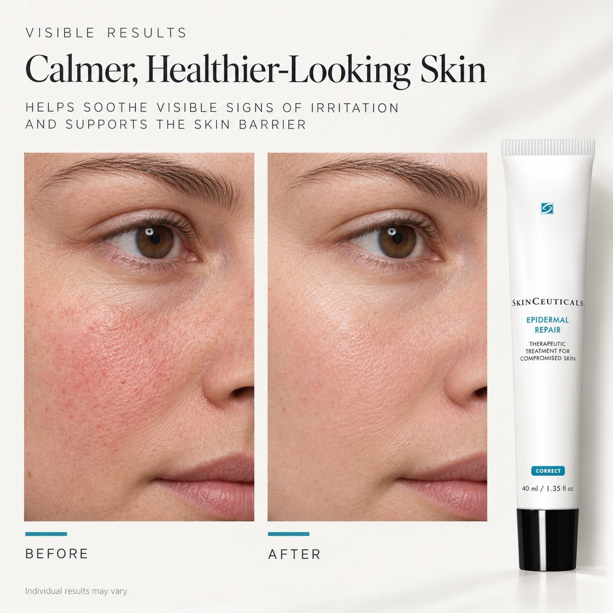 EPIDERMAL REPAIR 40ML