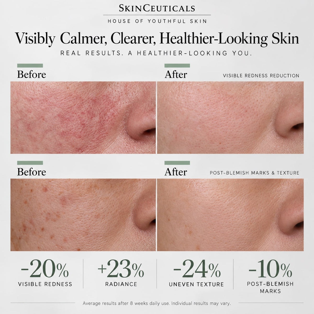 PHYTO CORRECTIVE SERUM 30ML