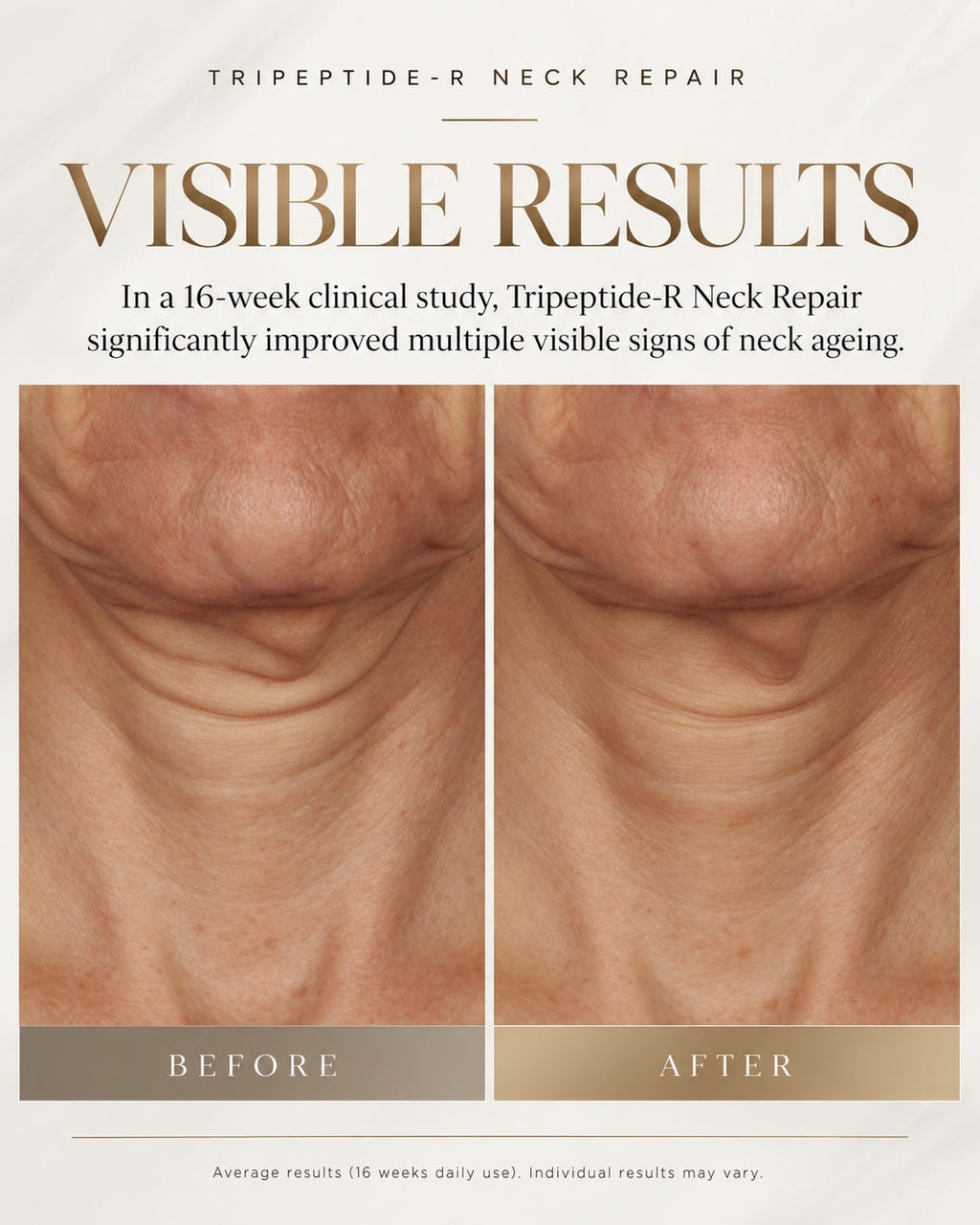 SKN COR TRIPEPTIDE NECK 50ML