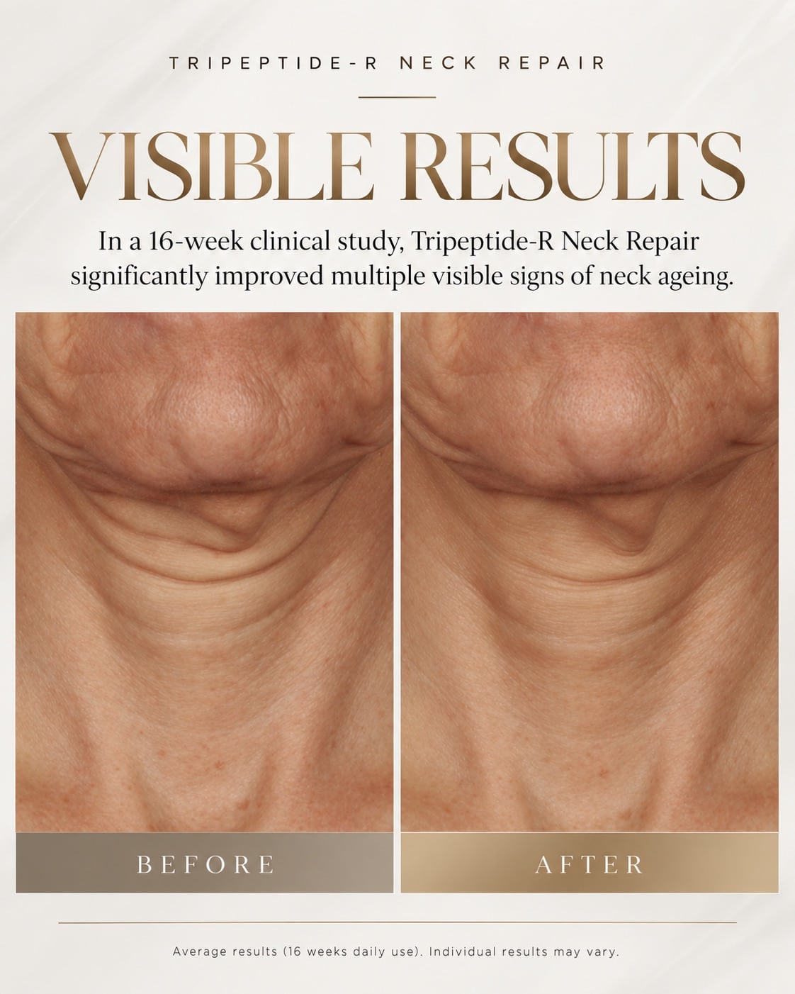 SKN COR TRIPEPTIDE NECK 50ML